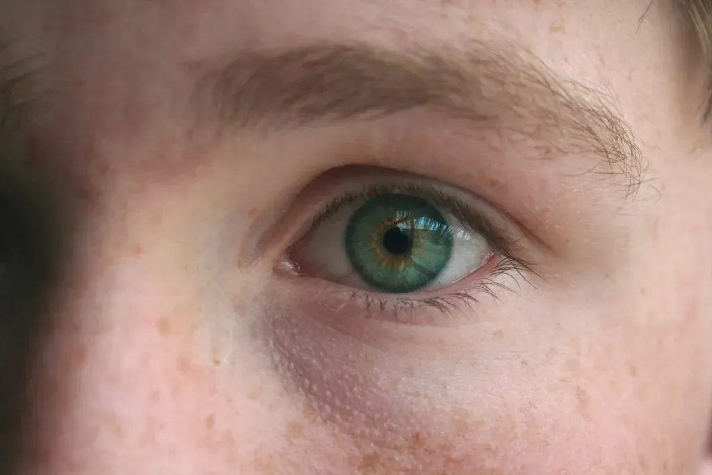 Extreme close-up of a green eye and the surrounding pale skin of the brow and cheek, scattered with small light-brown freckles.