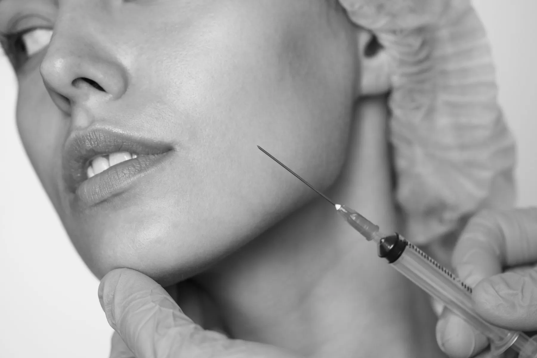Black and white close-up of a fine needle being placed along a client jawline by a gloved hand