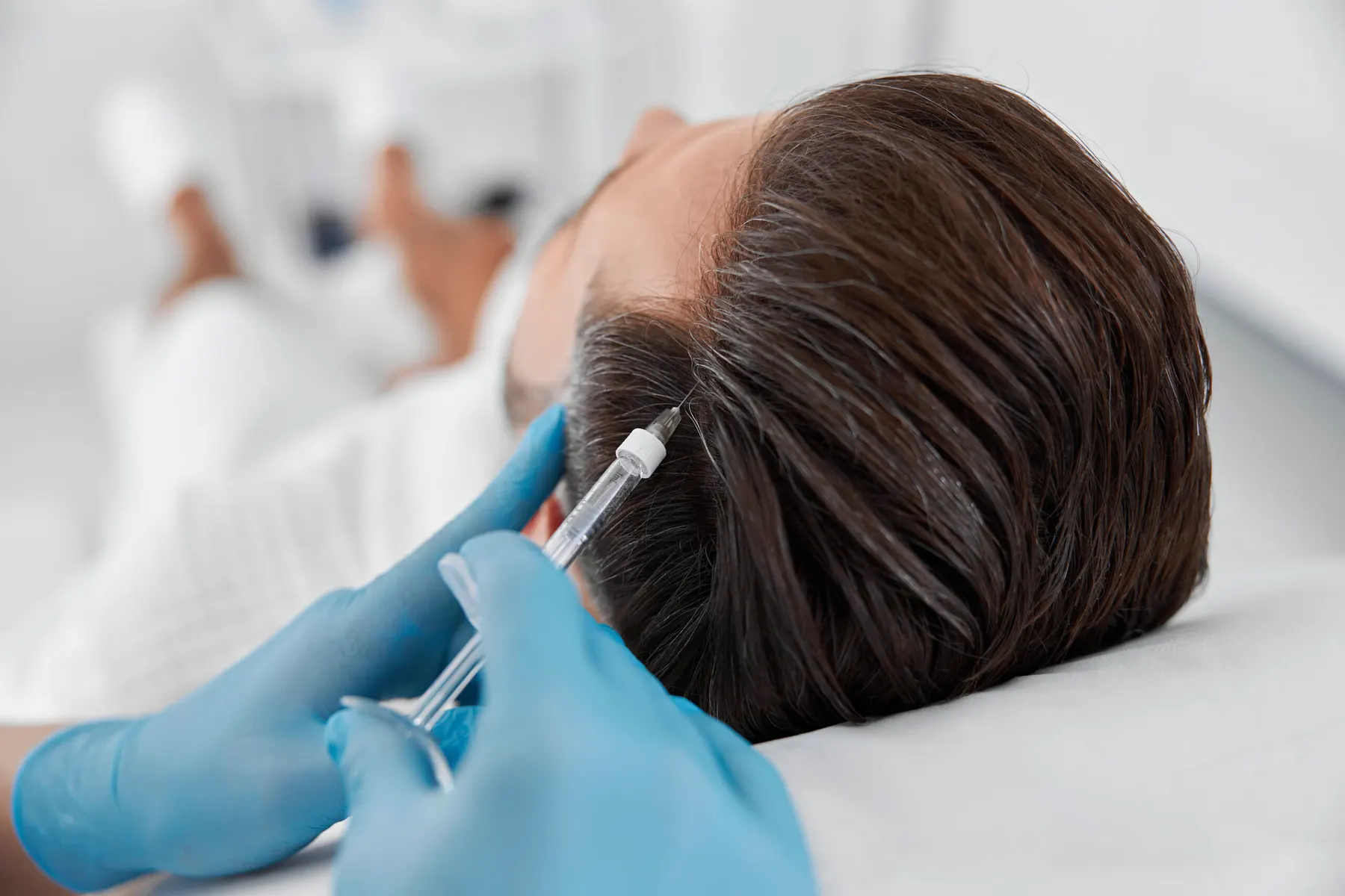 A client lying back in a bright treatment room while a practitioner in blue gloves places a fine needle along the hairline.