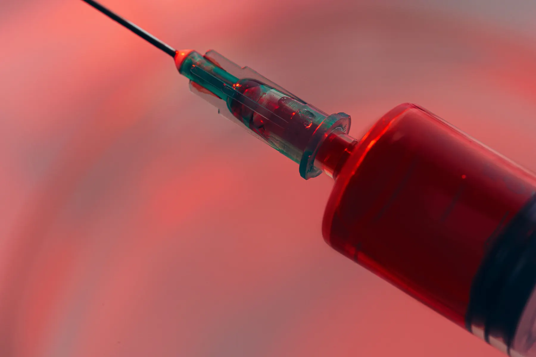 A syringe of drawn blood prepared for platelet-rich plasma separation