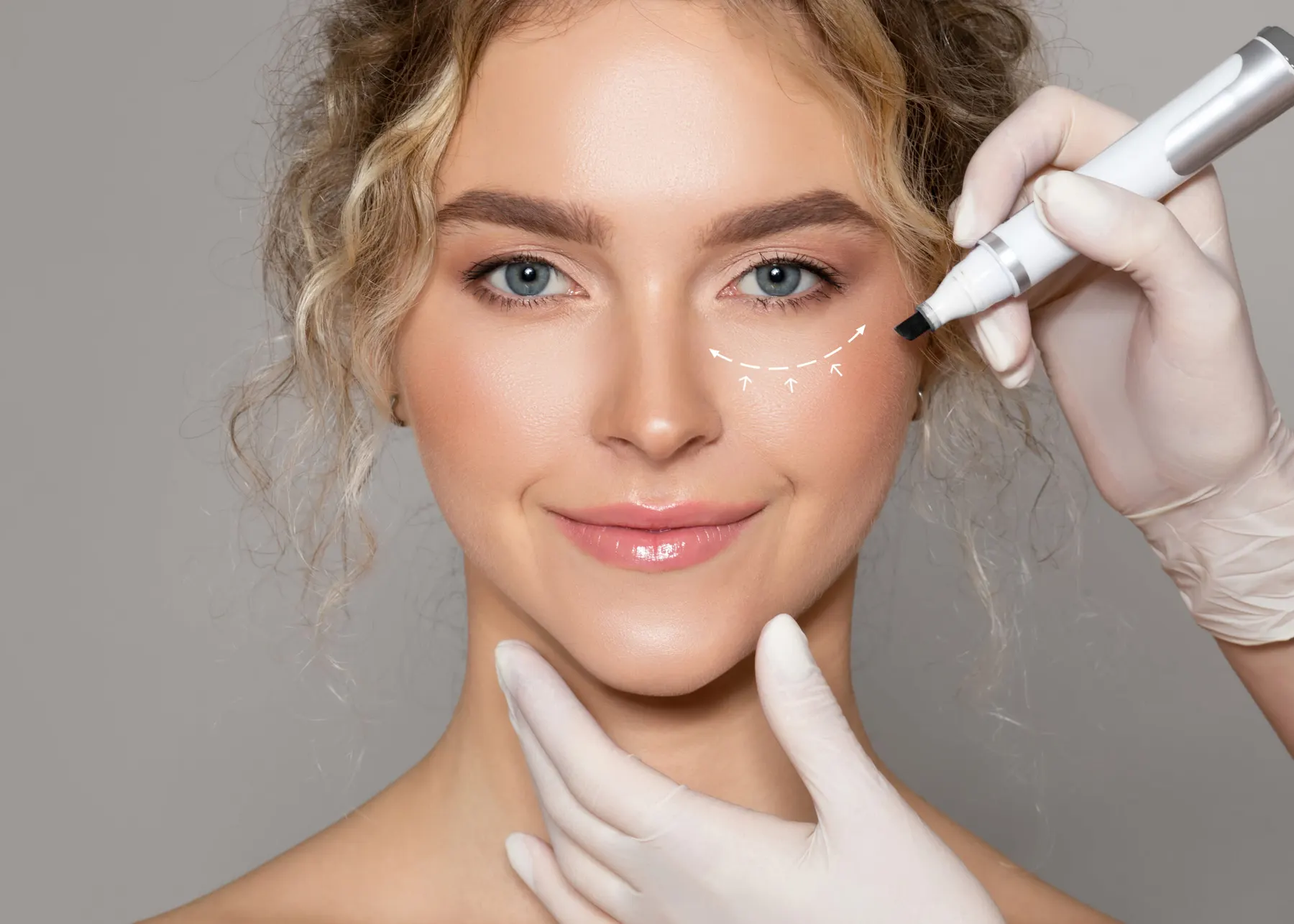 A practitioner marking small white dots under the eye of a client with a fine white pencil.