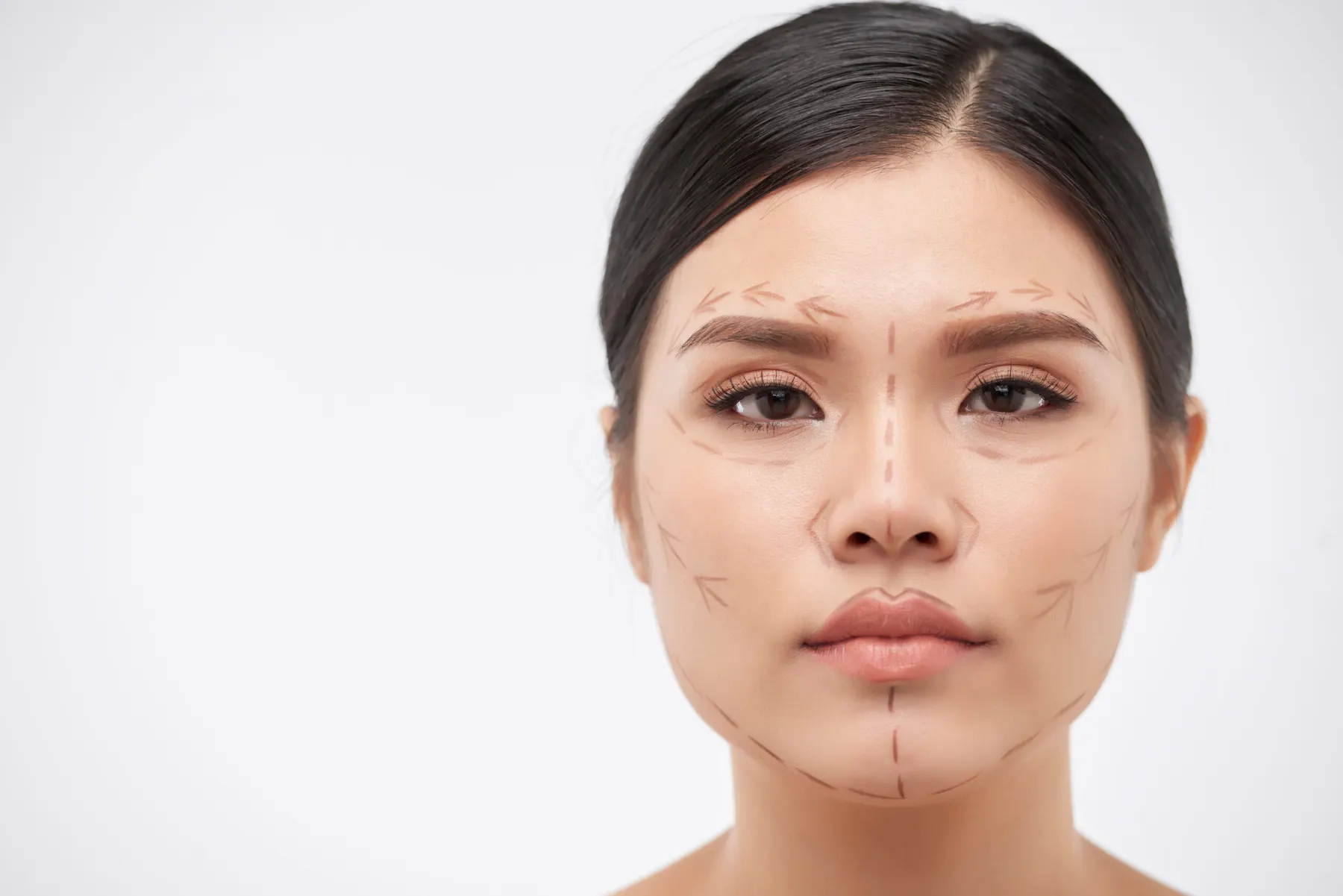 A woman facing the camera with dark planning lines drawn across her forehead, cheeks and jaw.