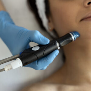 HydraFacial