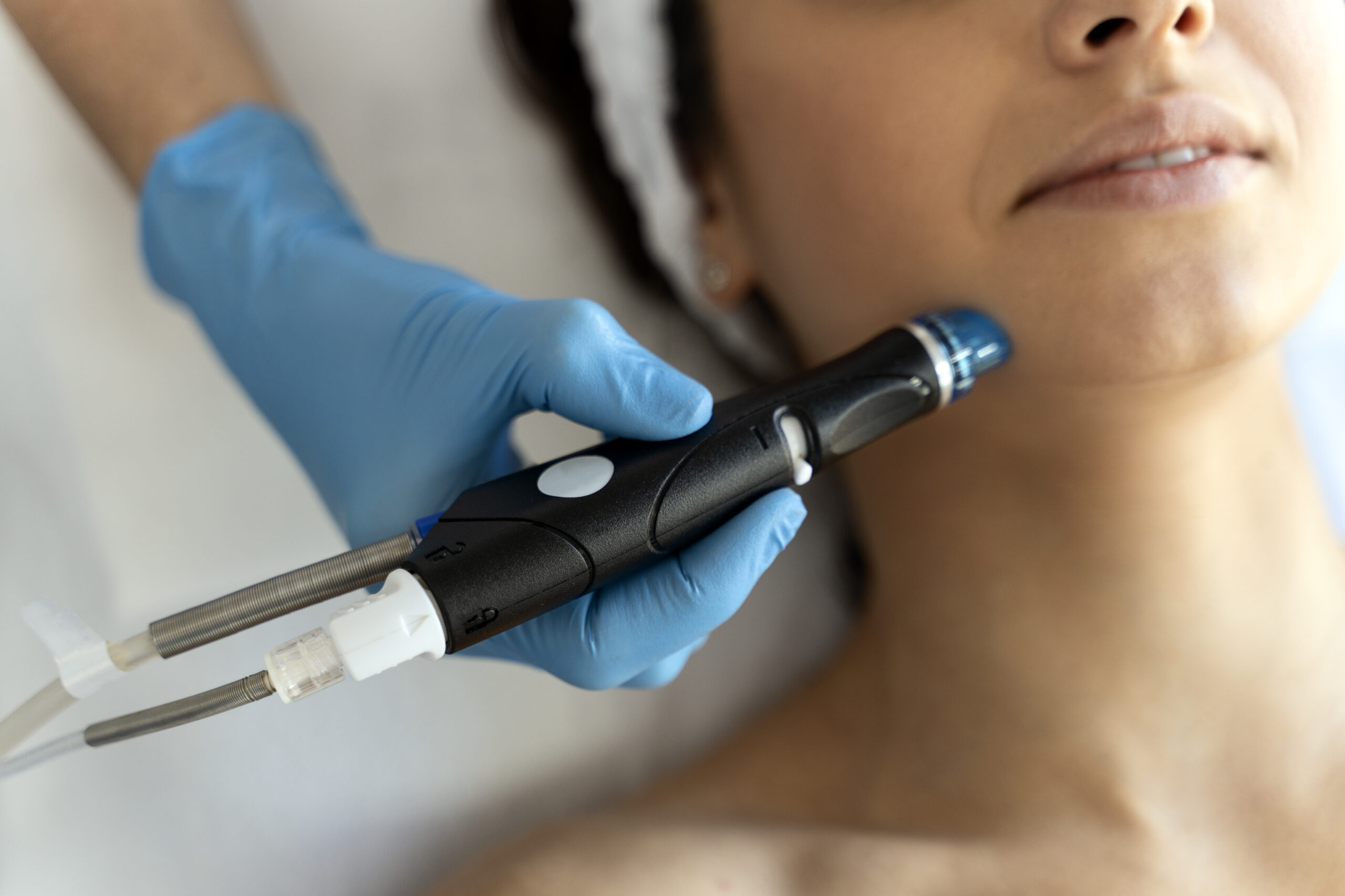HydraFacial