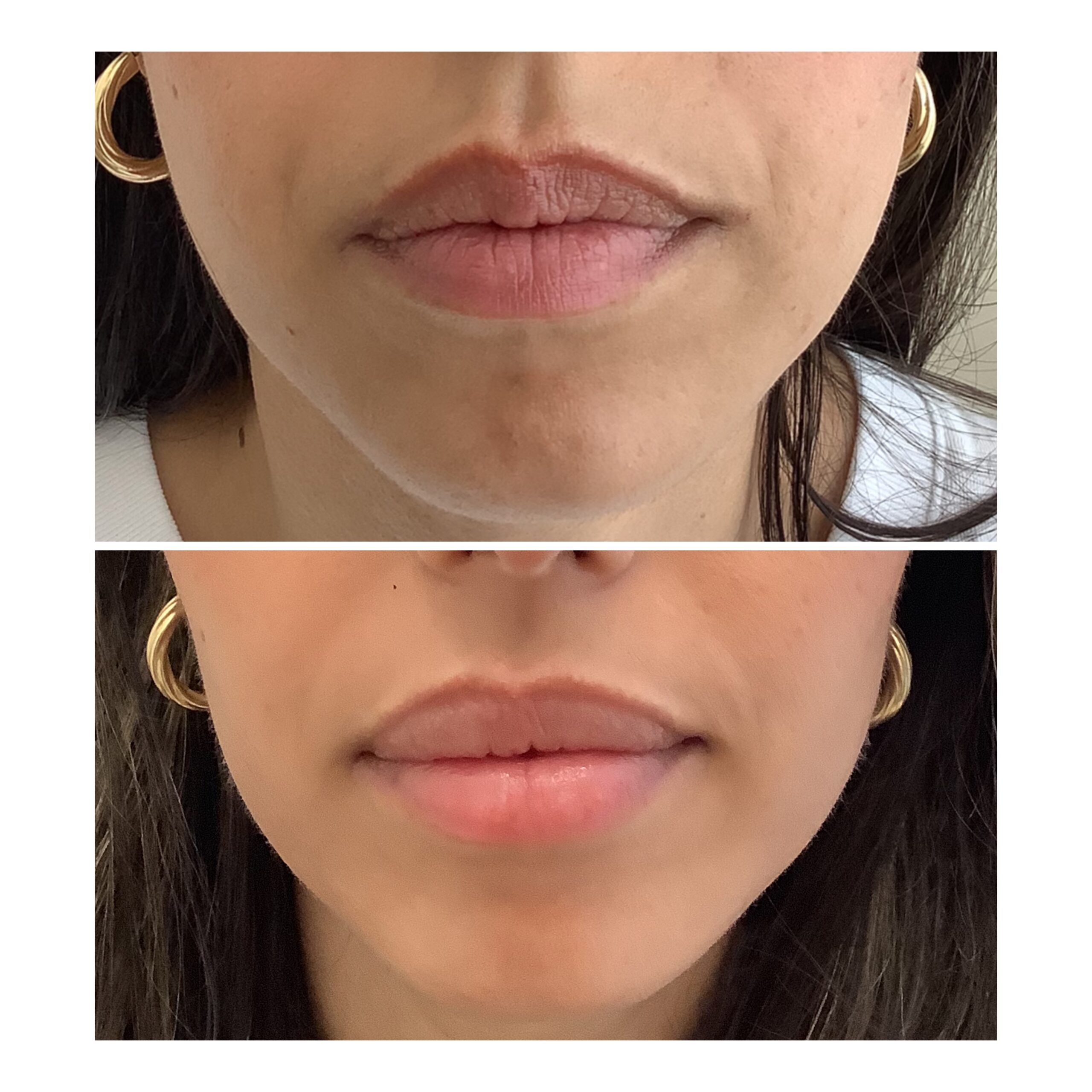Lip Plump