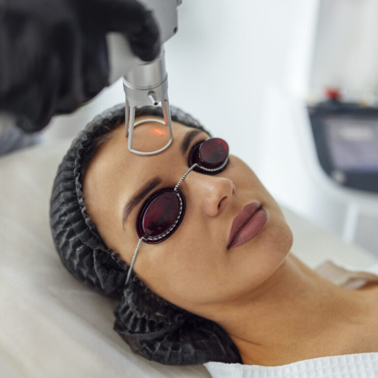 Closeup of the face of young woman undergoing laser resurfacing and peeling procedure in spa salon. Cosmetologist female client closed her eyes and rests during laser facial rejuvenation.